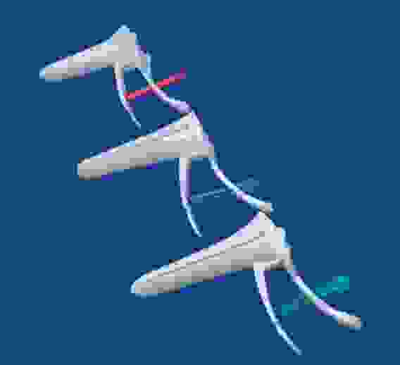 Зеркало гинекологическое стерильное №1 (белое)/Полимерные изделия/130